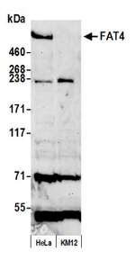 FAT4 Antibody in Western Blot (WB)