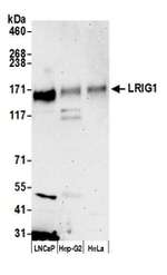 LRIG1 Polyclonal Antibody