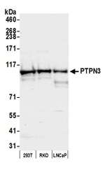 PTPN3 Polyclonal Antibody