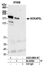 NCKAP5L Antibody in Immunoprecipitation (IP)