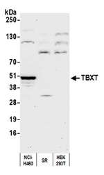 TBXT Polyclonal Antibody