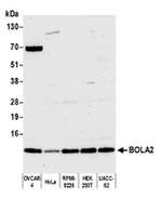 BOLA2 Polyclonal Antibody