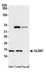 CLDN7 Polyclonal Antibody