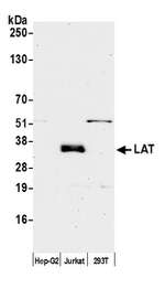 LAT Polyclonal Antibody