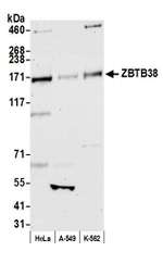 ZBTB38 Polyclonal Antibody
