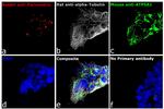 Rabbit IgG (H+L) Highly Cross-Adsorbed Secondary Antibody in Immunocytochemistry (ICC/IF)