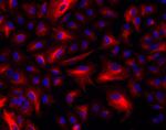 Donkey anti-Rabbit IgG (H+L) Highly Cross-Adsorbed Secondary Antibody, Alexa Fluor™ Plus 555