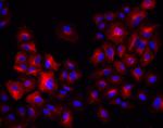 Rabbit IgG (H+L) Highly Cross-Adsorbed Secondary Antibody in Immunocytochemistry (ICC/IF)