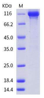 Human EGFR Fc Chimera Protein
