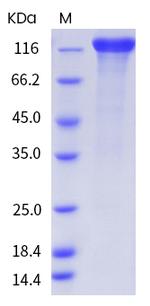 Human ErbB2 Fc Chimera Protein