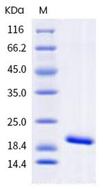 Human IL-1 beta Protein