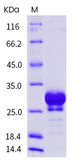 Human Fc gamma RIIB (CD32b) His-tag Protein