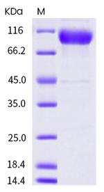 Human ICAM-1 (CD54) His-tag Fc Chimera Protein