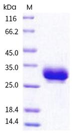Human Fc gamma RIIA (CD32a) (167 Arg/His) His-tag Protein