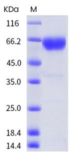 Human PD-1 His-tag Fc Chimera Protein