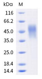 Human Fc gamma RIIIA (CD16a) (176 Val) His-tag Protein
