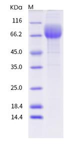 Human CD36 (SR-B3) His-tag Protein