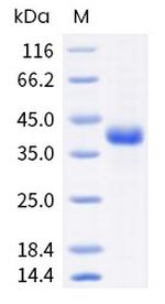 Human R-Spondin 1 (aa 1-263) Protein