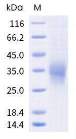 Human TREM-2 His-tag Protein