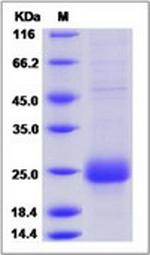 Human CTLA-4 His-tag Protein