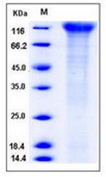 Human CD96 His-tag Protein