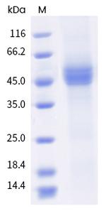 Human CD19 His-tag Protein