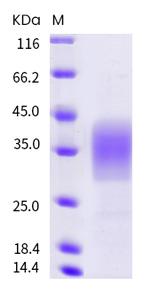 Mouse TREM-2 His-tag Protein