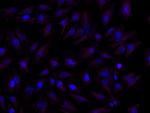 Rat IgG (H+L) Highly Cross-Adsorbed Secondary Antibody in Immunocytochemistry (ICC/IF)