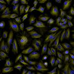 Rat IgG (H+L) Highly Cross-Adsorbed Secondary Antibody in Immunocytochemistry (ICC/IF)