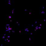 Human IgG (H+L) Cross-Adsorbed Secondary Antibody in Immunocytochemistry (ICC/IF)
