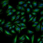 Rabbit IgG (H+L) Cross-Adsorbed Secondary Antibody in Immunocytochemistry (ICC/IF)