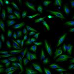 Rabbit IgG (H+L) Cross-Adsorbed Secondary Antibody in Immunocytochemistry (ICC/IF)
