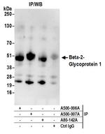 Beta-2-Glycoprotein 1 Antibody in Immunoprecipitation (IP)