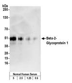 Beta-2-Glycoprotein 1 Monoclonal Antibody (7B8)