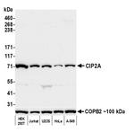 CIP2A Antibody in Western Blot (WB)