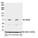 CIP2A Monoclonal Antibody (2A1-9A4)