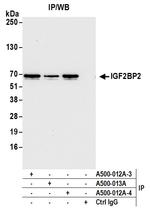 IGF2BP2 Antibody in Immunoprecipitation (IP)