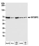 IGF2BP2 Monoclonal Antibody (1E3.01E5)