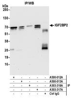 IGF2BP2 Antibody in Immunoprecipitation (IP)