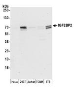 IGF2BP2 Monoclonal Antibody (3A3.5F1)