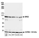 BRD2 Monoclonal Antibody (12C2E4)