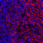 CD20 Antibody in Immunohistochemistry (Paraffin) (IHC (P))