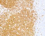 CD20 Antibody in Immunohistochemistry (Paraffin) (IHC (P))