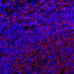CD20 Antibody in Immunohistochemistry (Paraffin) (IHC (P))