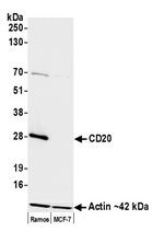 CD20 Antibody in Western Blot (WB)