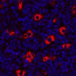 CD68 Antibody in Immunohistochemistry (Paraffin) (IHC (P))