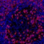 CD45RO Antibody in Immunohistochemistry (Paraffin) (IHC (P))