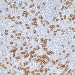 CD45RO Antibody in Immunohistochemistry (Paraffin) (IHC (P))
