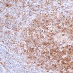 CD74 Antibody in Immunohistochemistry (Paraffin) (IHC (P))