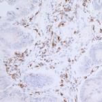 CD74 Antibody in Immunohistochemistry (Paraffin) (IHC (P))